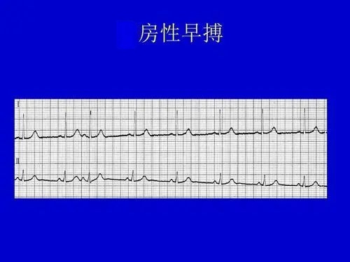 lQDPJxymA3wNF-fNAXfNAfSwkHBAeWPT234H2jmkEIwRAA_500_375